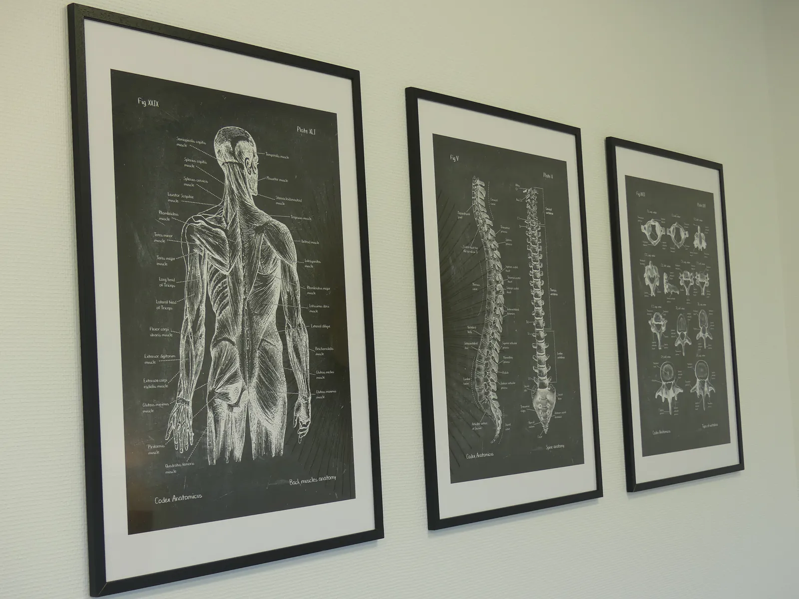 Planches d'anatomie encadrées : muscles, colonne vertébrale et crâne